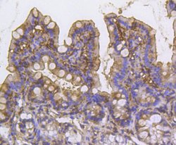 Invitrogen Cortactin Recombinant Rabbit Monoclonal Antibody (SC61-08) 100