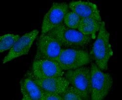 Invitrogen GAP43 Recombinant Rabbit Monoclonal Antibody (SC60-06) 100 &mu;L;