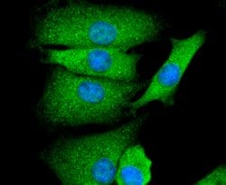 Invitrogen GAP43 Recombinant Rabbit Monoclonal Antibody (SC60-06) 100 &mu;L;