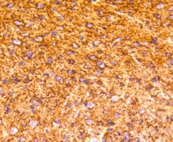 Invitrogen GAP43 Recombinant Rabbit Monoclonal Antibody (SC60-06) 100 &mu;L;