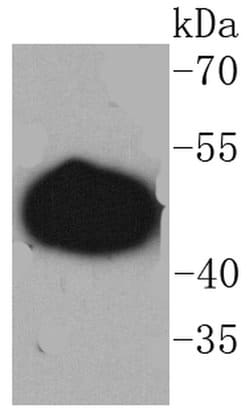 Invitrogen GAP43 Recombinant Rabbit Monoclonal Antibody (SC60-06) 100 &mu;L;
