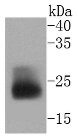 Invitrogen MUC1 Recombinant Rabbit Monoclonal Antibody (SN06-80) 100 &mu;L;