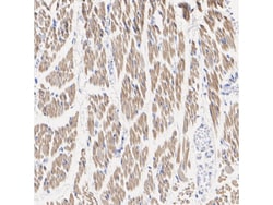 Invitrogen Phospho-HSL (Ser853) Recombinant Rabbit Monoclonal Antibody
