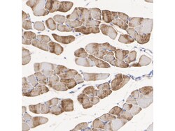 Invitrogen Phospho-HSL (Ser853) Recombinant Rabbit Monoclonal Antibody
