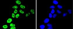 Invitrogen hnRNP C1/C2 Recombinant Rabbit Monoclonal Antibody (SN0652)