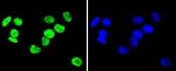 Invitrogen hnRNP C1/C2 Recombinant Rabbit Monoclonal Antibody (SN0652)
