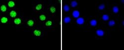 Invitrogen hnRNP C1/C2 Recombinant Rabbit Monoclonal Antibody (SN0652)