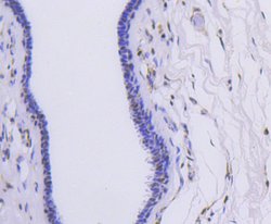 Invitrogen hnRNP C1/C2 Recombinant Rabbit Monoclonal Antibody (SN0652)