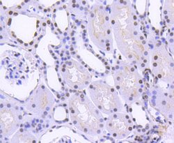 Invitrogen hnRNP C1/C2 Recombinant Rabbit Monoclonal Antibody (SN0652)