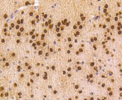 Invitrogen hnRNP C1/C2 Recombinant Rabbit Monoclonal Antibody (SN0652)