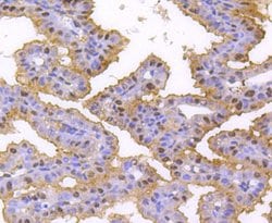 Invitrogen hnRNP C1/C2 Recombinant Rabbit Monoclonal Antibody (SN0652)