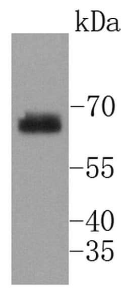 Invitrogen Phospho-SHP2 (Tyr542) Recombinant Rabbit Monoclonal Antibody (SN61-01) 100 &mu;L | Buy Online | Invitrogen&trade; | Fisher Scientific