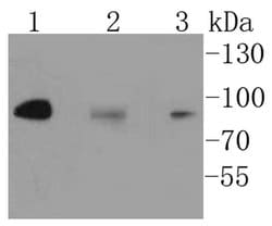 Invitrogen IKK alpha/beta Recombinant Rabbit Monoclonal Antibody (SN63-02)