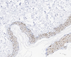 Invitrogen Phospho-c-Myc (Thr58) Recombinant Rabbit Monoclonal Antibody