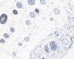 Invitrogen Phospho-c-Myc (Thr58) Recombinant Rabbit Monoclonal Antibody