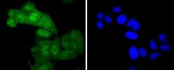 Invitrogen Phospho-c-Myc (Thr58) Recombinant Rabbit Monoclonal Antibody