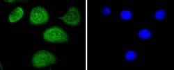 Invitrogen Phospho-c-Myc (Thr58) Recombinant Rabbit Monoclonal Antibody