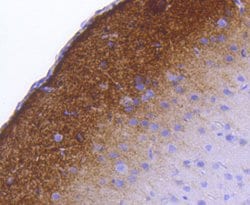 Invitrogen Phospho-Synapsin 1 (Ser9) Recombinant Rabbit Monoclonal Antibody
