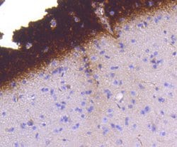 Invitrogen Phospho-Synapsin 1 (Ser9) Recombinant Rabbit Monoclonal Antibody