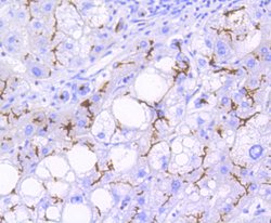 Invitrogen P-Glycoprotein Recombinant Rabbit Monoclonal Antibody (SN06-42)
