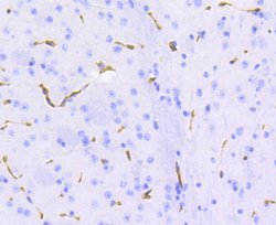 Invitrogen P-Glycoprotein Recombinant Rabbit Monoclonal Antibody (SN06-42)