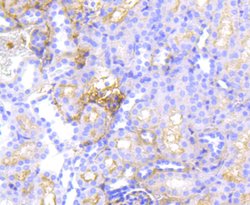 Invitrogen P-Glycoprotein Recombinant Rabbit Monoclonal Antibody (SN06-42)