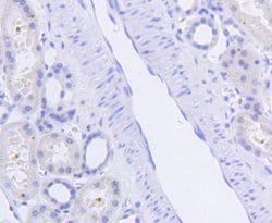 Invitrogen Phospho-SIRT1 (Ser47) Recombinant Rabbit Monoclonal Antibody