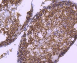 Invitrogen RAD18 Recombinant Rabbit Monoclonal Antibody (SN66-01) 100 &mu;L;
