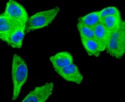 Invitrogen&trade;&nbsp;MMP11 Recombinant Rabbit Monoclonal Antibody (SN74-08)