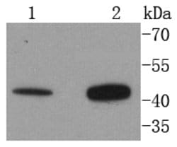 Invitrogen AGTR2 Recombinant Rabbit Monoclonal Antibody (SN71-03) 100 &mu;L;