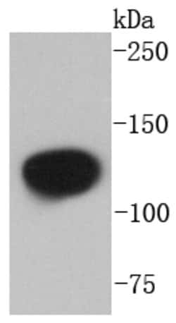 Invitrogen NEDD4L Recombinant Rabbit Monoclonal Antibody (SN73-03) 100 &mu;L | Buy Online | Invitrogen&trade; | Fisher Scientific