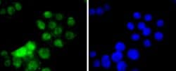 Invitrogen HNF4A Recombinant Rabbit Monoclonal Antibody (SN72-03) 100 &mu;L;
