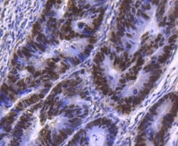 Invitrogen HNF4A Recombinant Rabbit Monoclonal Antibody (SN72-03) 100 &mu;L;