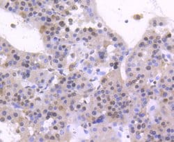 Invitrogen HNF4A Recombinant Rabbit Monoclonal Antibody (SN72-03) 100 &mu;L;