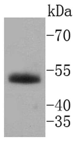 Invitrogen HNF4A Recombinant Rabbit Monoclonal Antibody (SN72-03) 100 &mu;L;