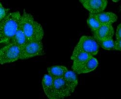 Invitrogen DJ-1 Recombinant Rabbit Monoclonal Antibody (SN07-21) 100 &mu;L;