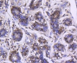 Invitrogen DJ-1 Recombinant Rabbit Monoclonal Antibody (SN07-21) 100 &mu;L;