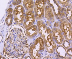 Invitrogen DJ-1 Recombinant Rabbit Monoclonal Antibody (SN07-21) 100 &mu;L;