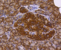 Invitrogen DJ-1 Recombinant Rabbit Monoclonal Antibody (SN07-21) 100 &mu;L;