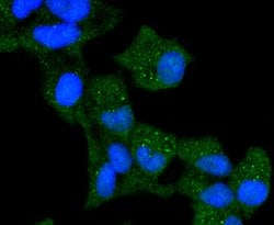 Invitrogen Cytokeratin 13 Recombinant Rabbit Monoclonal Antibody (SN71-09)