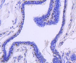Invitrogen Cytokeratin 13 Recombinant Rabbit Monoclonal Antibody (SN71-09)