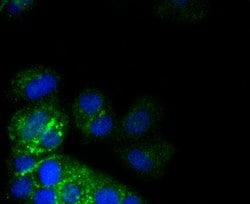 Invitrogen CD49b (Integrin alpha 2) Recombinant Rabbit Monoclonal Antibody