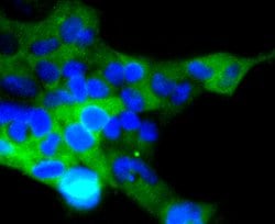 Invitrogen ACE2 Recombinant Rabbit Monoclonal Antibody (SN0754) 100 &mu;L | Buy Online | Invitrogen&trade; | Fisher Scientific