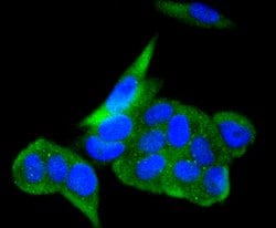 Invitrogen ACE2 Recombinant Rabbit Monoclonal Antibody (SN0754) 100 &mu;L | Buy Online | Invitrogen&trade; | Fisher Scientific