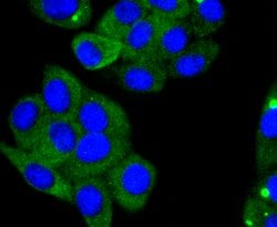 Invitrogen ACE2 Recombinant Rabbit Monoclonal Antibody (SN0754) 100 &mu;L | Buy Online | Invitrogen&trade; | Fisher Scientific