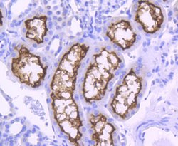 Invitrogen ACE2 Recombinant Rabbit Monoclonal Antibody (SN0754) 100 &mu;L | Buy Online | Invitrogen&trade; | Fisher Scientific