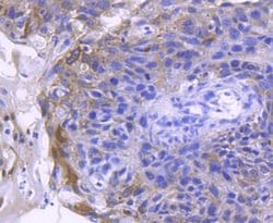 Invitrogen ACE2 Recombinant Rabbit Monoclonal Antibody (SN0754) 100 &mu;L | Buy Online | Invitrogen&trade; | Fisher Scientific