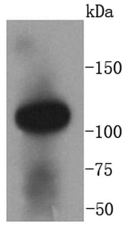 Invitrogen ACE2 Recombinant Rabbit Monoclonal Antibody (SN0754) 100 &mu;L | Buy Online | Invitrogen&trade; | Fisher Scientific