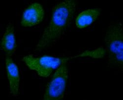 Invitrogen GYS1 Recombinant Rabbit Monoclonal Antibody (SN75-05) 100 &mu;L | Buy Online | Invitrogen&trade; | Fisher Scientific