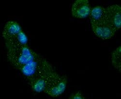 Invitrogen GYS1 Recombinant Rabbit Monoclonal Antibody (SN75-05) 100 &mu;L | Buy Online | Invitrogen&trade; | Fisher Scientific